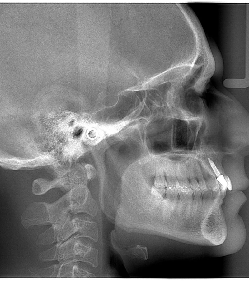 radiologia_berrini-documentacao_ortodontica