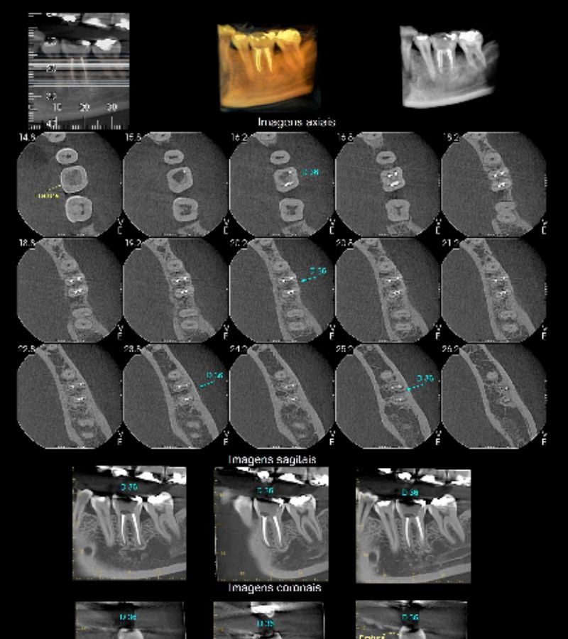 radiologia_berrini-tomografia-computadorizada-3