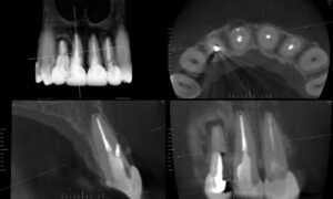 Radiologia Berrini Tomografia 1