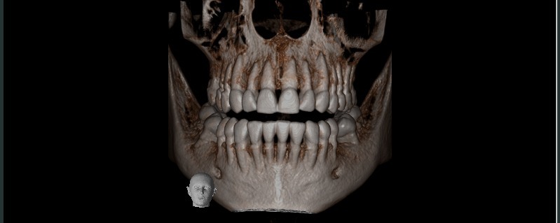 Radiologia Berrini Tomografia 2