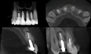 Radiologia Berrini Tomografia 3